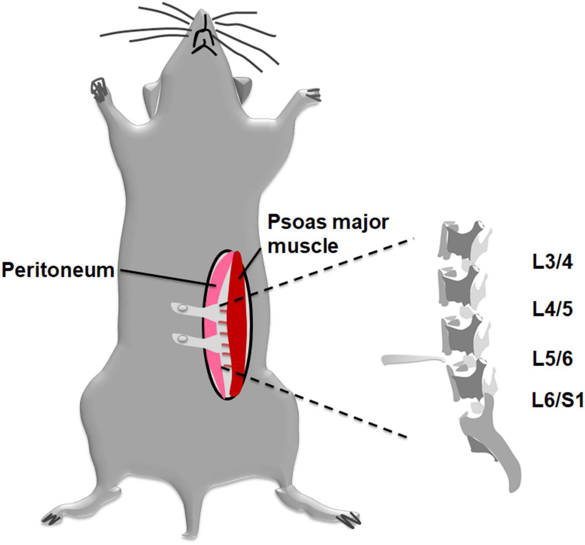 Estrogen receptor β/substance P signaling in spinal cord mediates antinociceptive effect in a mouse model of discogenic low back pain